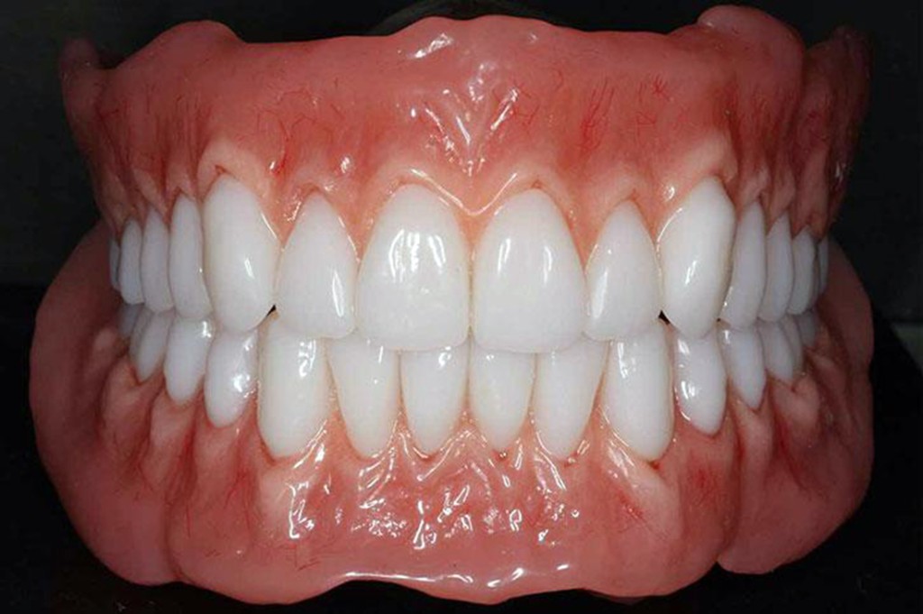 BPS dentures