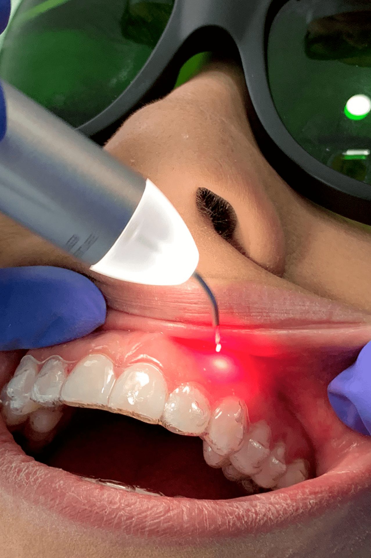 Advanced endodontic and periodontic equipments - image 4