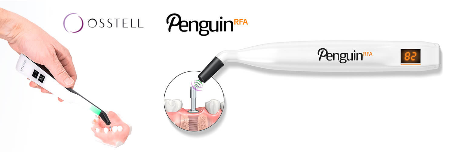 Advanced dental implant equipments - image 1