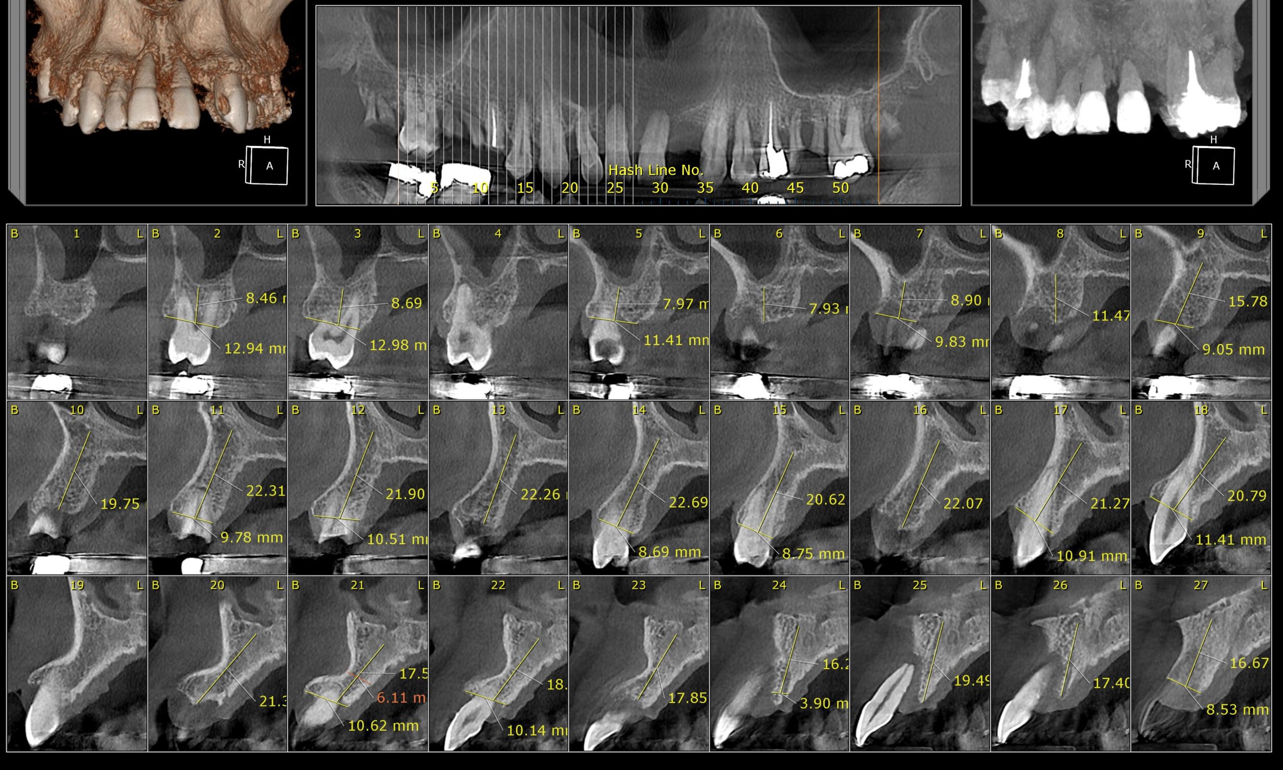 Digital radiography - image 1