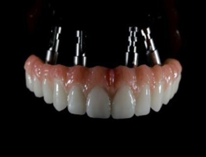 Dental material 3
