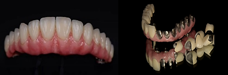 Dental material 5