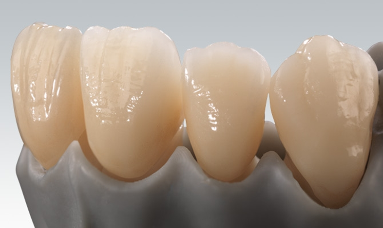 Dental material 8