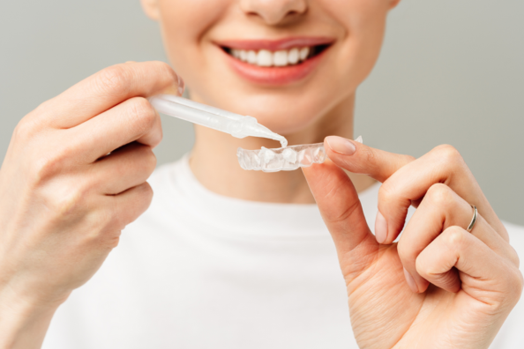 Diy teeth whitening facts