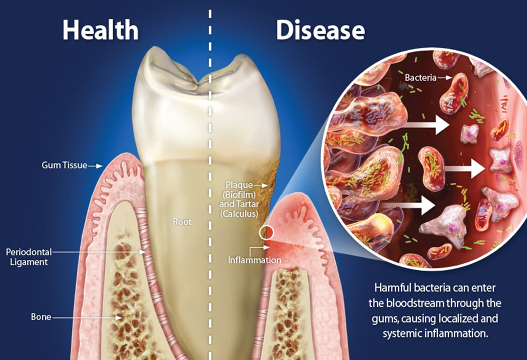 Dentistry and systemic health