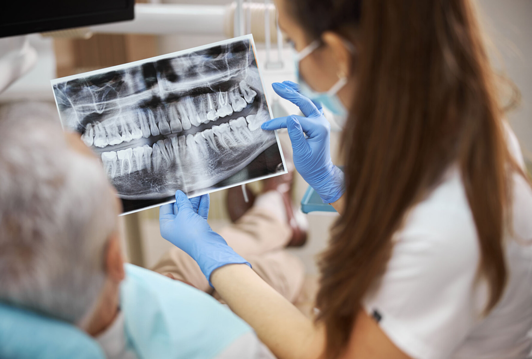 What are dental X-rays and why are they important in diagnosis